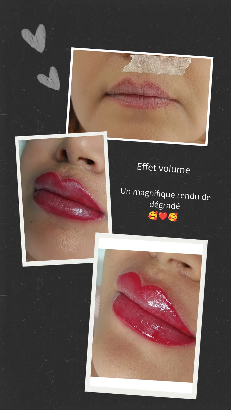 Lèvres après maquillage permanent